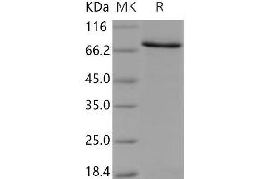 Western Blotting (WB) image for 6-phosphofructo-2-Kinase/fructose-2,6-Biphosphatase 3 (PFKFB3) protein (GST tag,His tag) (ABIN7194084) (PFKFB3 Protein (GST tag,His tag))