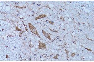 Immunohistochemistry of paraffin-embedded Rat spinal cord using HADH Polyclonal Antibody at dilution of 1:100 (40x lens). (HADH anticorps)