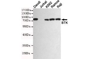 Western blot detection of BTK in Daudi,Jurkat(BTK negative),K562,Ramos and Raji cell lysates using BTK mouse mAb (1:1000 diluted). (BTK anticorps)