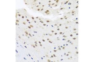 Immunohistochemistry of paraffin-embedded mouse brain using HD antibody (ABIN6128012, ABIN6141669, ABIN6141672 and ABIN6213648) at dilution of 1:100 (40x lens). (HDAC4 anticorps  (AA 451-650))
