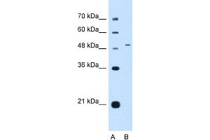 WB Suggested Anti-NR0B1 Antibody Titration:  0. (NR0B1 anticorps  (Middle Region))