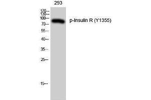 Western Blotting (WB) image for anti-Insulin Receptor (INSR) (pTyr1355) antibody (ABIN3182541) (Insulin Receptor anticorps  (pTyr1355))