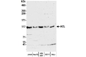 Western Blotting (WB) image for anti-ATP Citrate Lyase (ACLY) (AA 350-400) antibody (ABIN7449939) (ACLY anticorps  (AA 350-400))
