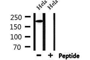 Western blot analysis of extracts from Hela, using Collagen Valpha 1 Antibody. (COL5A1 anticorps  (N-Term))