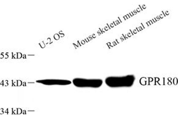 GPR180 anticorps
