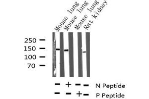 Western blot analysis of Phospho-Met (Tyr1234) expression in various lysates (c-MET anticorps  (pTyr1234))