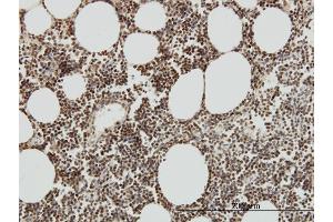 Immunoperoxidase of monoclonal antibody to TAF7 on formalin-fixed paraffin-embedded human lymph node.