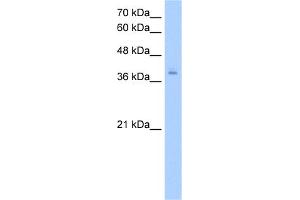 WB Suggested Anti-PCBP2 Antibody Titration:  2. (PCBP2 anticorps  (N-Term))