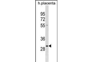 RAB22A Antibody (C-term) (ABIN1536769 and ABIN2850288) western blot analysis in human placenta tissue lysates (35 μg/lane).