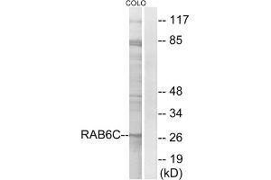 Western blot analysis of extracts from COLO cells, using RAB6C antibody. (WTH3DI anticorps  (Internal Region))