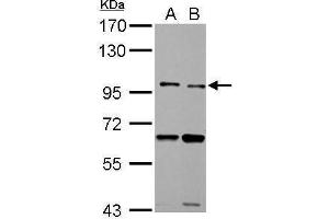 WB Image TLR5 antibody detects TLR5 protein by Western blot analysis. (TLR5 anticorps  (N-Term))