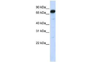 WB Suggested Anti-AMOT Antibody Titration:  0. (Angiomotin anticorps  (N-Term))