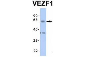 Host:  Rabbit  Target Name:  VEZF1  Sample Type:  Human Adult Placenta  Antibody Dilution:  1.