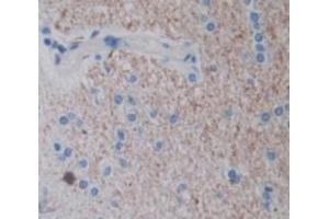 IHC-P analysis of Human Tissue, with DAB staining. (CSN3 anticorps  (AA 24-181))