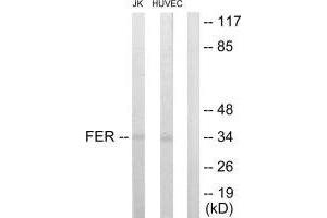 Western blot analysis of extracts from JK and HUVEC cells, using FER antibody. (FER anticorps  (C-Term))