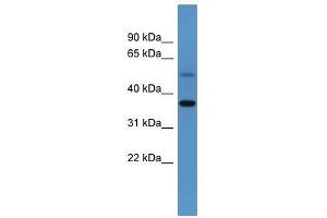 Gyg antibody used at 0. (GYG anticorps  (C-Term))