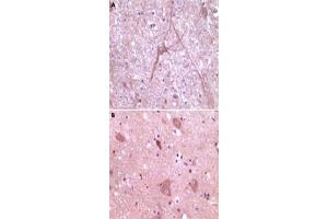 Immunohistochemical analysis of paraffin-embedded human cerebrum (A) and myelencephalon (B) tissue, showing cytoplasmical localization, using DNM2 monoclonal antibody, clone 5E4C2F3  with DAB staining.