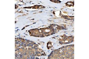 IHC analysis of TTLL2 using anti-TTLL2 antibody (ABIN7600850).