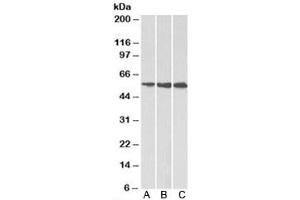 Western blot testing of A) HeLa, B) HepG2 and C) K562 cell lysate using HMGCS1 antibody at 1ug/ml. (HMGCS1 anticorps)