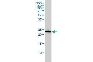 VBP1 monoclonal antibody (M01), clone 3D11 Western Blot analysis of VBP1 expression in HL-60 .