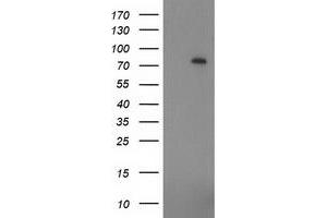Western Blotting (WB) image for anti-Zinc Finger, Imprinted 2 (ZIM2) (AA 1-150), (AA 428-527) antibody (ABIN1490589) (ZIM2 anticorps  (AA 1-150, AA 428-527))