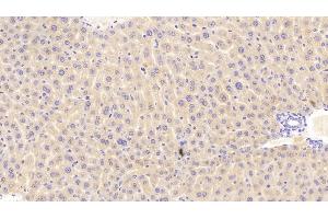Detection of PCK1 in Mouse Liver Tissue using Polyclonal Antibody to Phosphoenolpyruvate Carboxykinase 1, Soluble (PCK1) (PCK1 anticorps  (AA 312-563))
