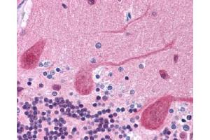 IHC Image for AP23211PU-N Human Brain, Cerebellum: Formalin-Fixed, Paraffin-Embedded (FFPE)
