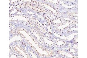 ABIN6267315 at 1/200 staining human kidney tissue sections by IHC-P.