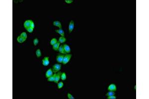 Immunofluorescent analysis of PC-3 cells using ABIN7162107 at dilution of 1:100 and Alexa Fluor 488-congugated AffiniPure Goat Anti-Rabbit IgG(H+L) (SEPSECS anticorps  (AA 5-451))