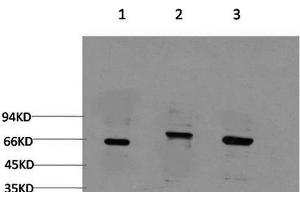 Western Blot analysis of 1) 293T, 2) C2C12, 3) Rat brain using BECN1 Monoclonal Antibody at dilution of 1:2000. (Beclin 1 anticorps)
