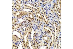 Immunohistochemistry of paraffin-embedded rat kidney using ANP32A Antibody.