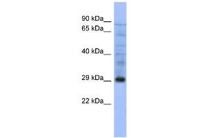 WB Suggested Anti-PSMA5  Antibody Titration: 0.