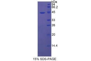 SDS-PAGE of Protein Standard from the Kit (Highly purified E. (TPSAB1 Kit CLIA)