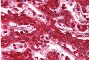 Human Breast: Formalin-Fixed, Paraffin-Embedded (FFPE)