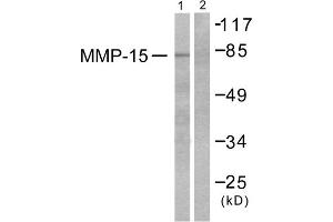 Western blot analysis of extracts from MDA-MB-435 cells, using MMP-15 antibody (ABIN5976459).