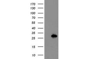 Western Blotting (WB) image for anti-Latexin (LXN) antibody (ABIN1499100) (Latexin anticorps)