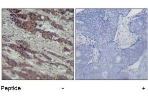 Image no. 2 for anti-V-Raf-1 Murine Leukemia Viral Oncogene Homolog 1 (RAF1) (Ser338) antibody (ABIN319325) (RAF1 anticorps  (Ser338))