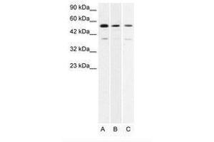Image no. 1 for anti-H2.0-Like Homeobox (HLX) (AA 257-306) antibody (ABIN202646) (HLX anticorps  (AA 257-306))