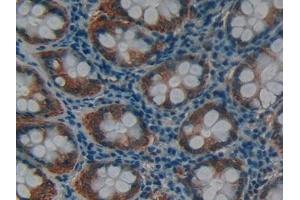 Detection of MMP12 in Human Rectum Tissue using Polyclonal Antibody to Matrix Metalloproteinase 12 (MMP12)