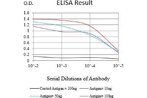 Black line: Control Antigen (100 ng),Purple line: Antigen (10 ng), Blue line: Antigen (50 ng), Red line:Antigen (100 ng) (Cytokeratin 13 anticorps  (AA 104-458))