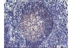 Image no. 4 for anti-Regulatory Factor X-Associated Ankyrin Containing Protein (RFXANK) antibody (ABIN1500685)