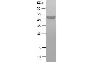 Western Blotting (WB) image for DEAD (Asp-Glu-Ala-Asp) Box Polypeptide 39B (DDX39B) (AA 1-428) protein (His tag) (ABIN7122607) (DDX39B Protein (AA 1-428) (His tag))