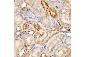 anti-Granulin (GRN) antibody