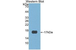 Western Blotting (WB) image for anti-Cystatin E/M (CST6) (AA 29-149) antibody (ABIN1867420) (CST6 anticorps  (AA 29-149))