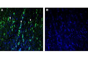 Expression of TMEM175 in rat medial septum. (TMEM175 anticorps  (AA 278-291))