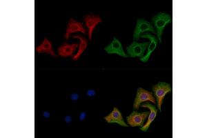 Vimentin mouse monoclonal Antibody staining Hela cells by IF/ICC.
