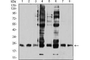 Western blot analysis using RALB mouse mAb against HepG2 (1), COS7 (2), NIH/3T3 (3), A549 (4), U251 (5), HT-29 (6), HEK293 (7), and LOVO (8) cell lysate.
