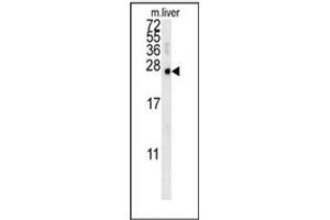 Western blot analysis of MCEE Antibody (C-term) in mouse liver tissue lysates (15ug/lane).