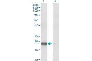 Western Blot analysis of ARPC3 expression in transfected 293T cell line by ARPC3 monoclonal antibody (M06), clone 2E11. (ARPC3 anticorps  (AA 1-78))
