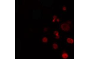ABIN6274330 staining Hela cells by IF/ICC. (FOXL1 anticorps  (Internal Region))